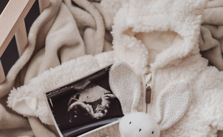 An ultrasound picture of the fetus and a bunny toy on a fluffy coat.